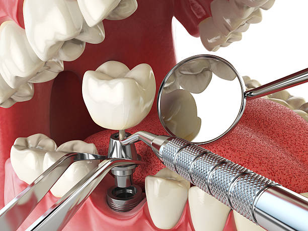 Best Emergency Dental Extractions in Shoshone, ID